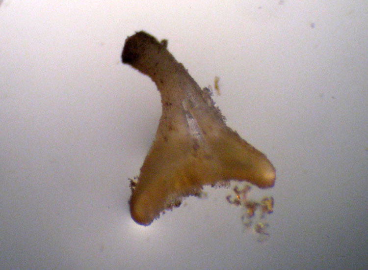 Forse non � Hymenoscyphus fructigenus ....